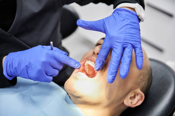 Best Emergency Root Canal Treatment in Manson, WA